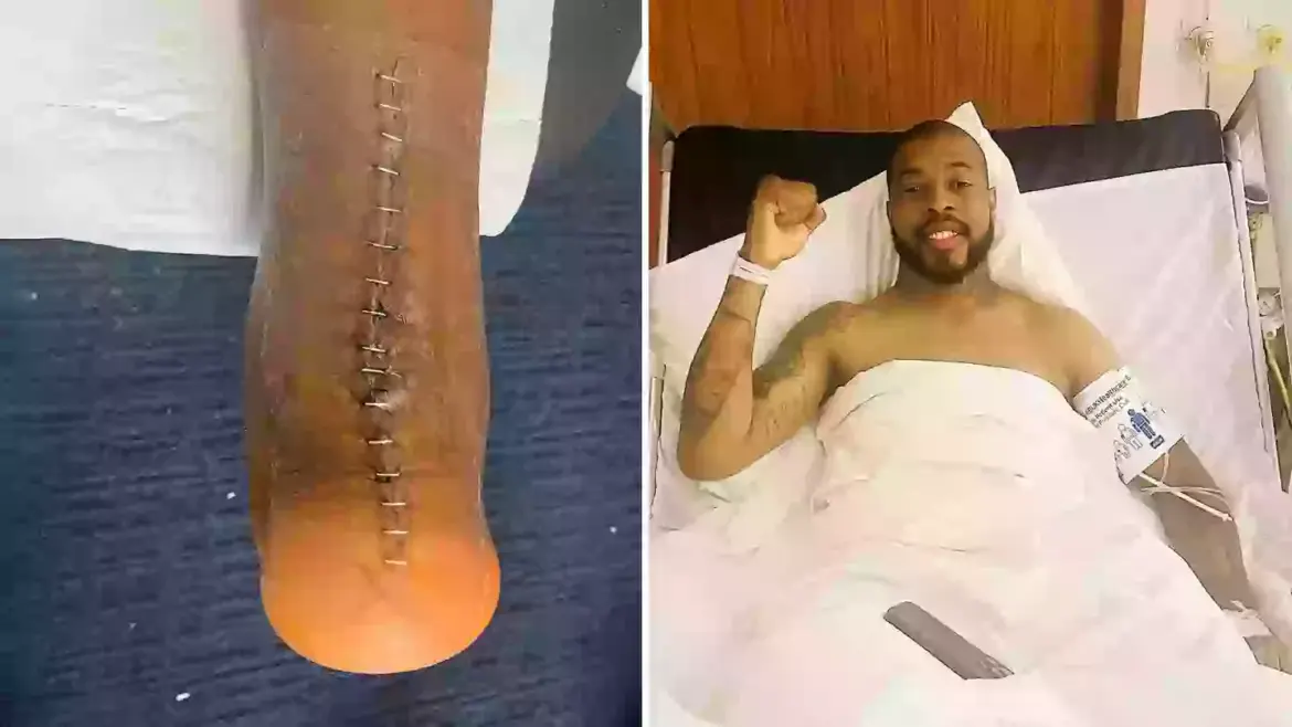 Kimpembe's achilles injury in May last year. Image credit: Instagram/kimpembe3